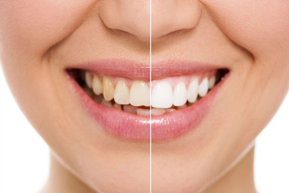 Αισθητική Οδοντιατρική